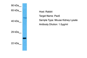 PAX6 Rabbit Polyclonal Antibody