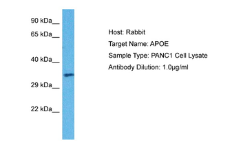 APOE Rabbit Polyclonal Antibody