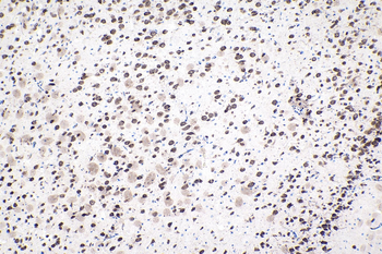 Multi-rAb Polymer HRP-Goat Mouse Recombinant Secondary Antibody (H+L)