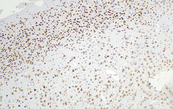 Multi-rAb Polymer HRP-Goat Mouse Recombinant Secondary Antibody (H+L)