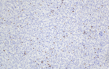 Multi-rAb Polymer HRP-Goat Mouse Recombinant Secondary Antibody (H+L)