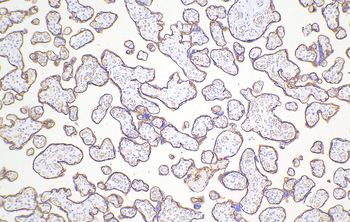 Multi-rAb Polymer HRP-Goat Rabbit Recombinant Secondary Antibody (H+L)