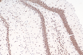 Multi-rAb Polymer HRP-Goat Rabbit Recombinant Secondary Antibody (H+L)