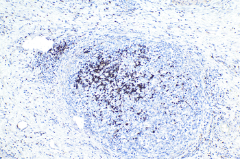 Multi-rAb Polymer HRP-Goat Rabbit Recombinant Secondary Antibody (H+L)