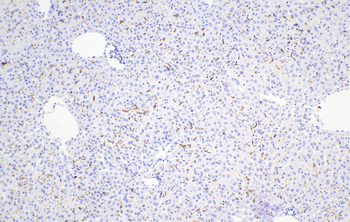Multi-rAb Polymer HRP-Goat Rabbit Recombinant Secondary Antibody (H+L)