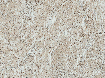 ATG7 Antibody (APC)
