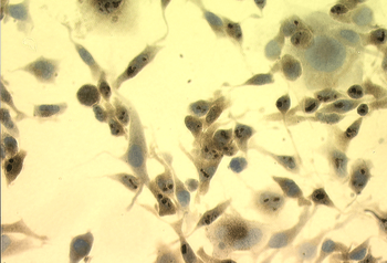 HSP70 Antibody (APC)