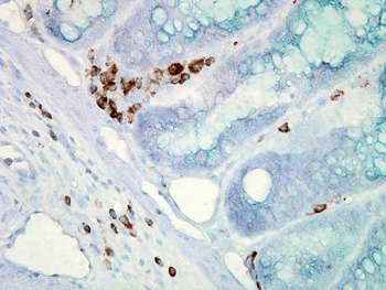 HSP70 Antibody (PerCP)