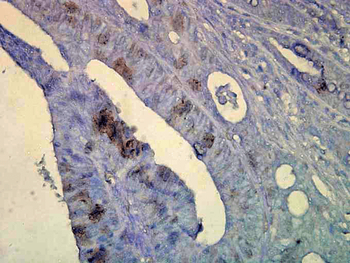 HSP70 Antibody (RPE)
