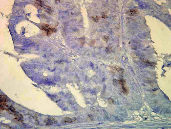 HSP70/HSC70 Antibody (HRP)