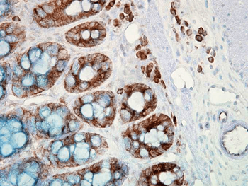 HSP90 Antibody (APC)
