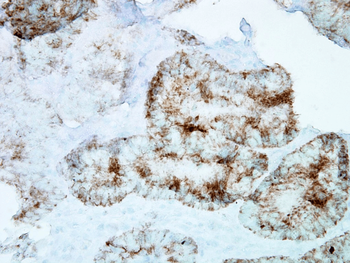 HSP60 Antibody (Biotin)