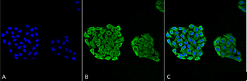 HSP70 Antibody (RPE)
