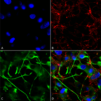 VAChT Antibody (APC)