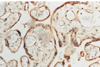 SOD1 (Cu/Zn) Antibody (RPE)
