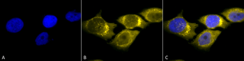 SOD2 (Mn) Antibody (APC)