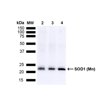 SOD2 (Mn) Antibody (APC)