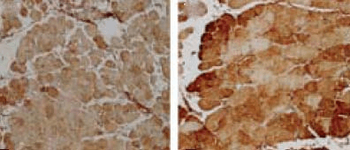 SOD2 (Mn) Antibody (FITC)