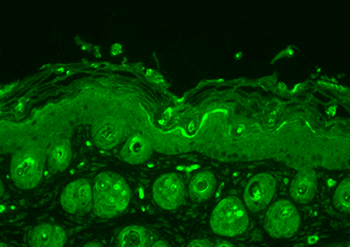 Ubiquitin Antibody (Biotin)