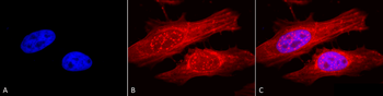 Alpha B Crystallin Antibody (Biotin)