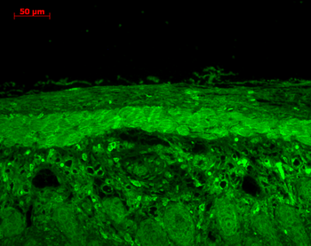 HSP22 Antibody (Biotin)