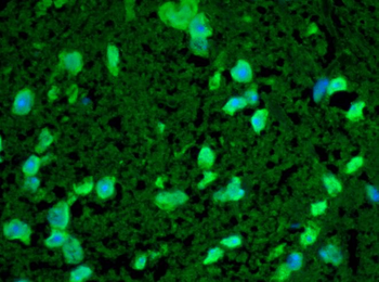 HSP22 Antibody (Biotin)
