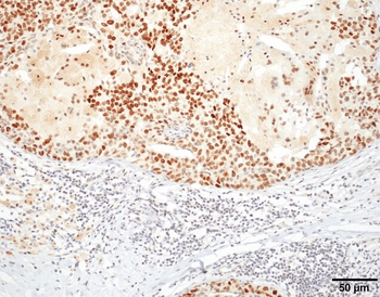 HSF1 Antibody (PerCP)