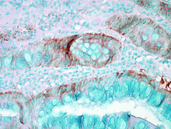 HSP70 Antibody (RPE)