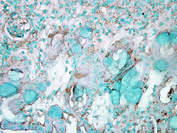 HSP70 Antibody (RPE)