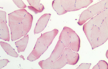 HSP27 Antibody (Biotin)