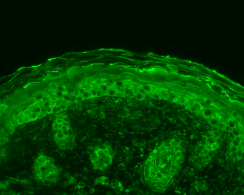 Calnexin-CT Antibody (Biotin)