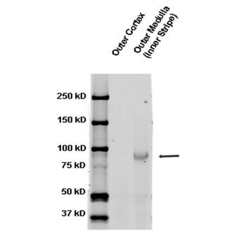 ENaC beta Antibody (APC)