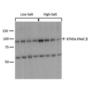 ENaC beta Antibody (APC)
