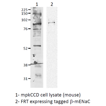 ENaC beta Antibody (HRP)