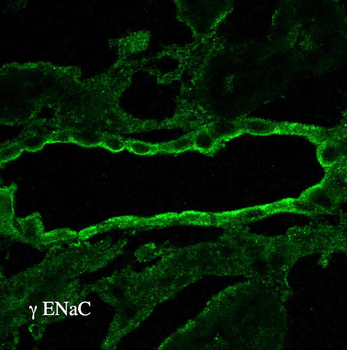 ENaC gamma Antibody (APC)