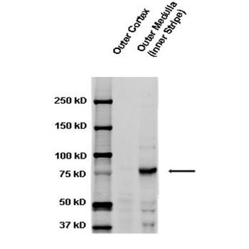 ENaC gamma Antibody (APC)