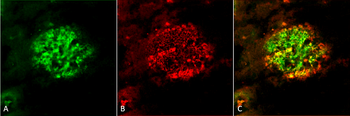 Amyloid Fibrils (OC) Antibody (APC)