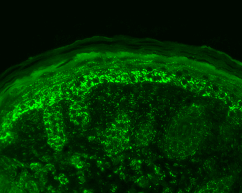 Cpn10 Antibody (FITC)