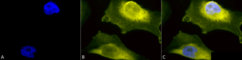 SOD1 (UbetaB) Antibody (HRP)