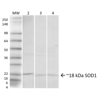 SOD1 (UbetaB) Antibody (HRP)