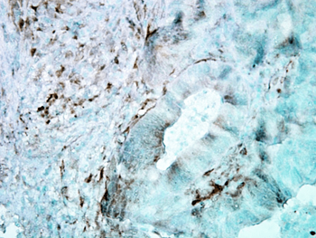 HSP27 Antibody (Biotin)