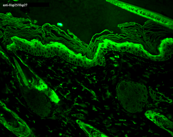 HSP27 Antibody (Biotin)