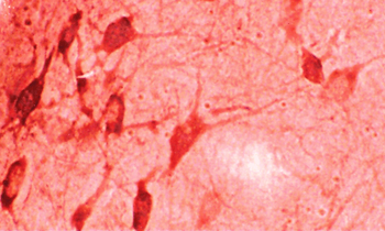HO-1 Antibody (FITC)