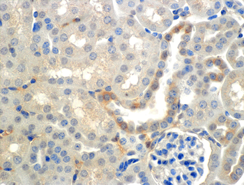 ENaC beta Antibody (APC)