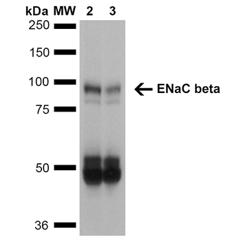 ENaC beta Antibody (APC)