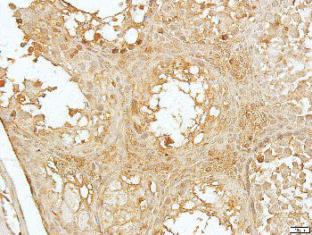 FSHR Rabbit Polyclonal Antibody