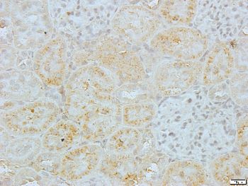 FSHR Rabbit Polyclonal Antibody