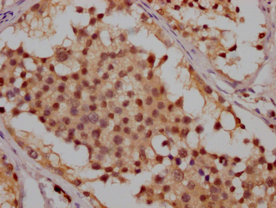 ATM Antibody