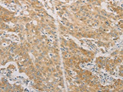 ACSL4 Antibody