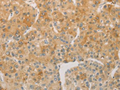 ACSL4 Antibody